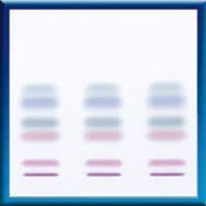 Picture of ALUGRAM Xtra Nano-SILGUR, 10x10 818432